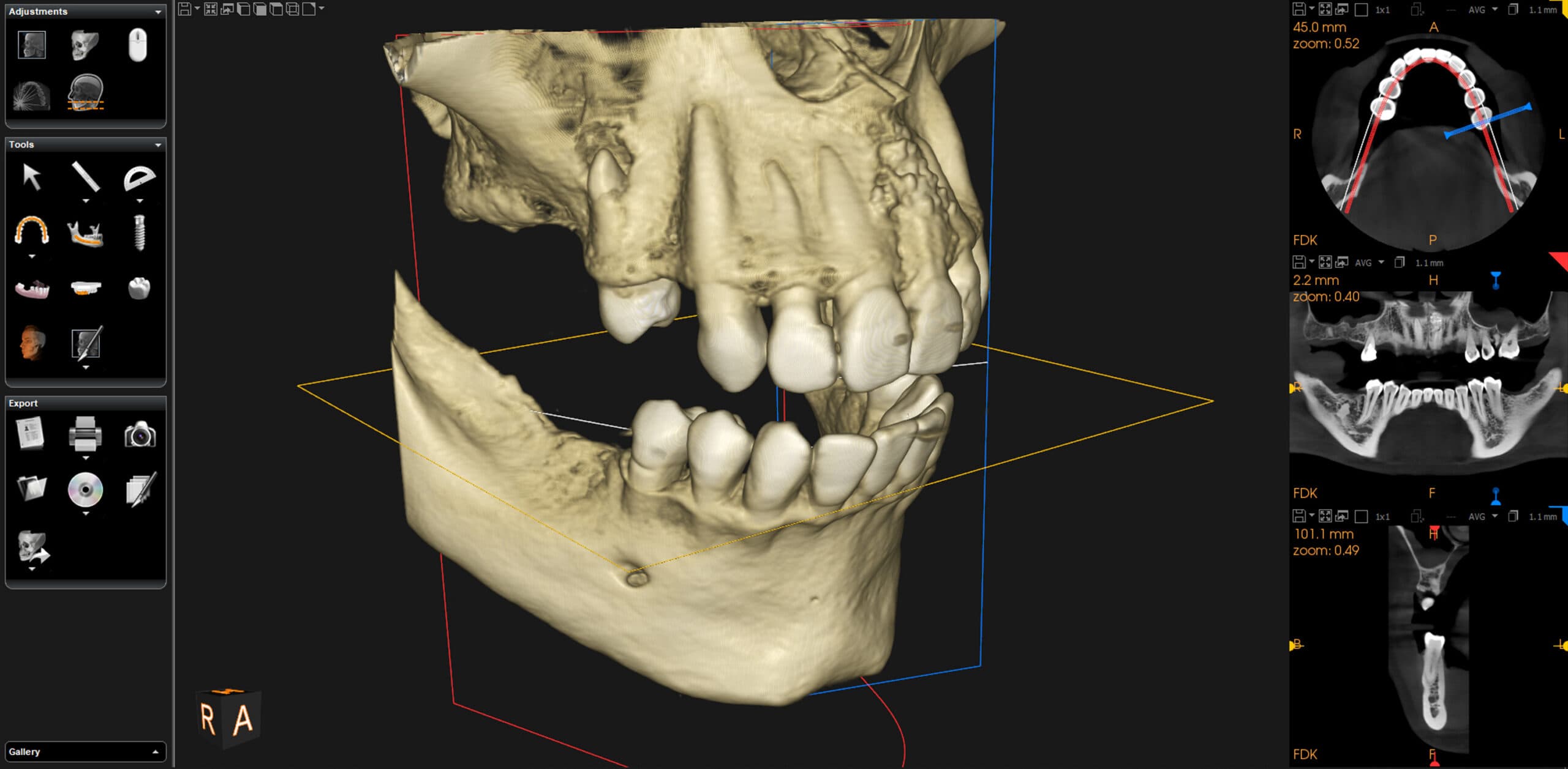 Lire un CBCT : méthodologie pas à pas pour l'omnipraticien