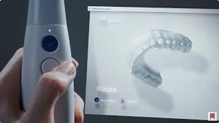 Numériser une limite cervicale de manière optimale