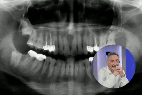 Formation Cone Beam CT 3D — Dr Yves Ponchet