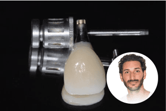 Prothèse sur Implant — Dr Benjamin Attuil
